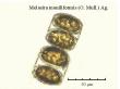 melosira moniliformis